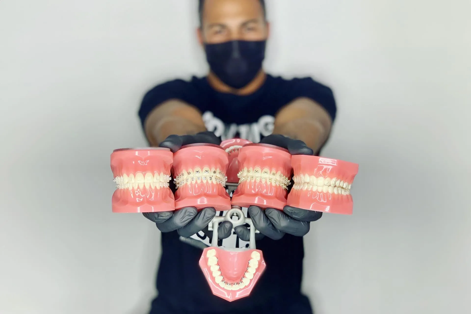 Types Of Braces: Metal, Ceramic, And Invisalign